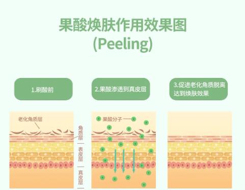 科普|“刷酸”爲什麼(me)要到醫院做？